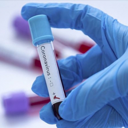 Россияда бир суткада 21,7 миң адамдан коронавирус аныкталды