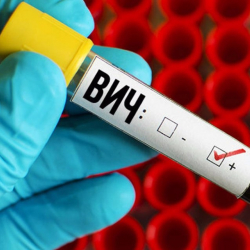 Кыргызстанда СПИД менен ооругандардын саны көбөйүүдө