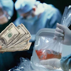 Чет өлкөдө өз органын саткан кыргызстандыктар