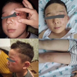 Сокулукта сабалган 6 жашар баланын жактоочусу тергөөчүлөргө карата арыз жазды