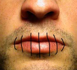 Бишкекте абакта отурган жарандар оозун тигишти