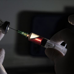 COVID-19га каршы эмделген аялдын чуулгандуу өлүмү