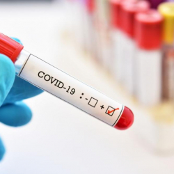 COVID-19: Вируска анализ тапшыргандардын саны бир аптада эки эсеге өстү