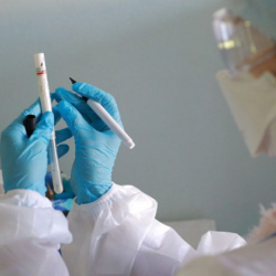 Мукаш Бейшембаев: “Коронавирустун кесепетинен өлүм жана майыптуулуктун көрсөткүчтөрү жогору”