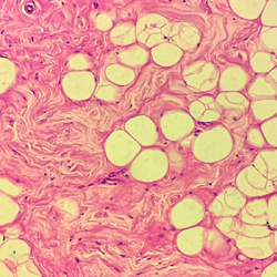 Раскрыт новый способ справиться с диабетом