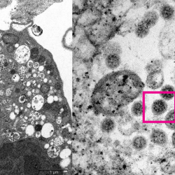 ВИДЕО - Омикрон штаммынын алгачкы сүрөтү жарыяланды