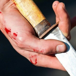 Түркияда бычакталган кыргызстандык кыз. ТИМ анын абалын айтты