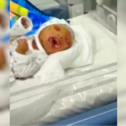 СҮРӨТ - Ага-ини куда болгондордун балдары майып төрөлдү