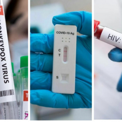 Италиялык жаран бир убакта ВИЧ, коронавирус жана маймыл чечегин жуктуруп алган