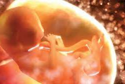 Загрязнение воздуха приводит к появлению 1 млн мертворожденных младенцев в год