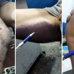 19 жаштагы кыздын өлүмүнө шектелген адам убактылуу кармоочу жайда дубинка менен зордукталган