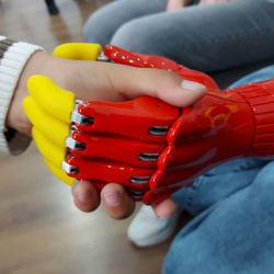 Кыргызстанда заманбап кол протездери жасалып 13 балага акысыз берилди