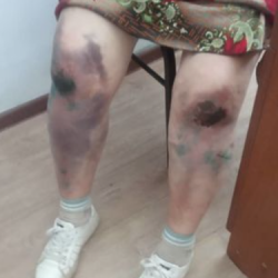 Изнасилование и избиение женщины в Ак-Суу. Подозреваемый водворен в СИЗО