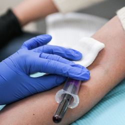 Кыргызстанда күйдүргү жуктурган адам аныкталды