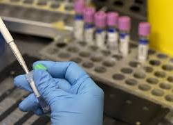 В Анкаре 4 человека госпитализированы с подозрением на оспу обезьян