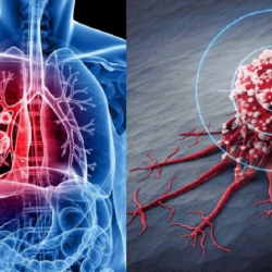 Кыргызстанда ракка чалдыккандардын саны эмне себептен өсүүдө?