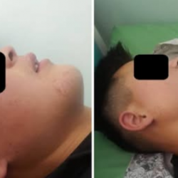 Ошто окуучу сабалып, ооруканага түшкөн. Милиция эмне дейт?