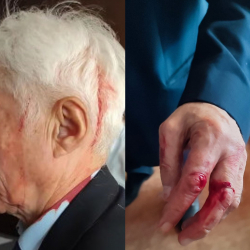 Турсунбек Акун мейманканада жаракат алганы боюнча милициянын маалыматы