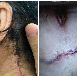 Министрлик: Одоно мыйзам бузган 78 жеке клиниканын иши токтотулду