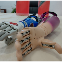 Эмгек министрлиги: 2025-жылы 11,5 миңден ашуун адам протездик-ортопедиялык кызматтарды алды